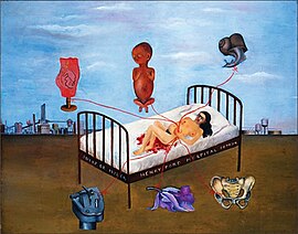 Henry Ford Hospital (1932) depicts Frida Kahlo's personal experience of miscarriage while hospitalized in Detroit.